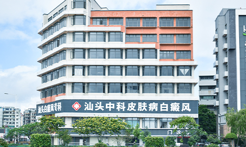 治疗白癜风医院 治疗白癜风医院