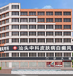 白癜风治疗医院