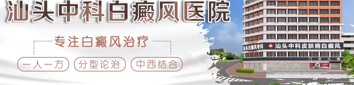 汕头中科白癜风医院 汕头中科白癜风医院