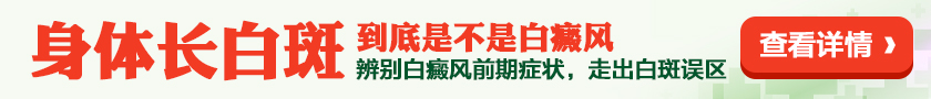 白癜风专治医院